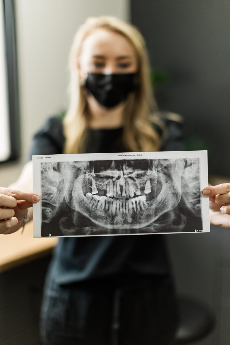 A specialist holding a panoramic dental radiograph.